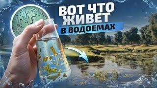 ЭТИ ЗАБОЛЕВАНИЯ из-за плохой очистки воды