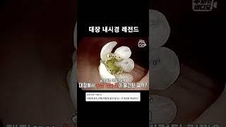 대장 내시경 중 발견된 대장 속 활짝 핀 꽃 #Shorts