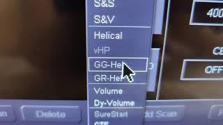 CT Scan Modes: Helical, GG-Helical, GR-Helical, Volume | Toshiba Aquilion One