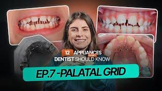 EP.7: Definitive solution for OPEN BITE?