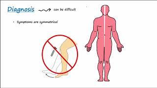 Guillain-Barre Syndrome (GBS) (Described Concisely)