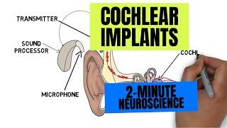 2-Minute Neuroscience: Cochlear Implants