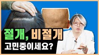 모발이식 절개 vs 비절개 채취방법 고민중이세요?