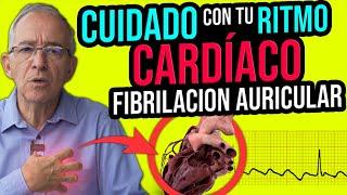 CUIDADO CON TU RITMO CARDIACO, FIBRILACION AURICULAR - Oswaldo Restrepo RSC