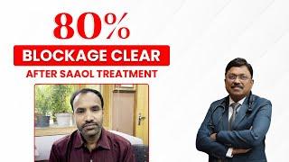 Patient Testimonial #110 | 80% blockage clear after Saaol Treatment | Dr. Bimal Chhajer | SAAOL