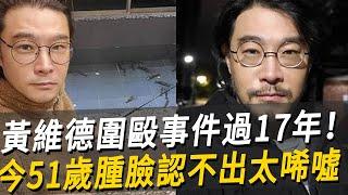 黄维德围殴事件过17年！颧骨碎裂留旧伤，今51岁肿脸认不出，现遭报应活得不如狗#黄维德 #伊能静 #飞龙在天 #娱乐八点档