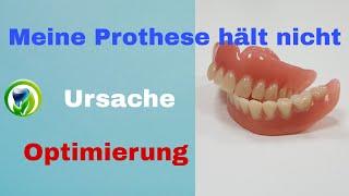 Warum saugt/hält meine Totalprothese nicht? Wie entsteht der Saugeffekt? Prothese optimieren