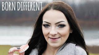 I Lost All My Teeth Aged 23 | BORN DIFFERENT