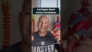 3rd Degree Block Patient Breakdown