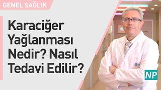 Karaciğer Yağlanması Nedir? Nasıl Tedavi Edilir?