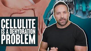 Cellulite is a Dehydration Problem! | What the Fitness | Biolayne