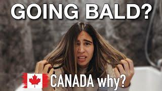 IS LOSING HAIR SCARY? I GOT YOU! |  LIFE IN CANADA