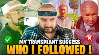 Hair Transplnat Post Operation Care Tips | Who I followed Rana Hamza or Mubashir Siddiqui