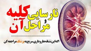 نارسایی کلیه چیست و چه علائم و مراحلی دارد؟ #کلیه