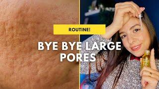 حل المسام الواسعة وبدايل ارخص - Large pores routine