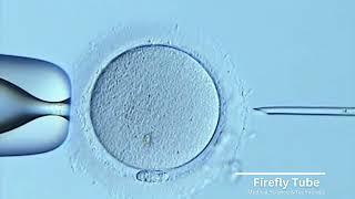 Fertility Associates ICSI Footage