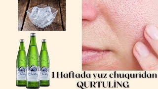 1Haftada yuzdagi chuqurlarni yuqotish Yuzdagi poralardan qurtilish #makeuptutorial