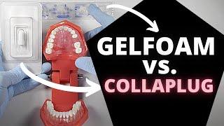 Collaplug® vs. Gel Foam | OnlineExodontia.com