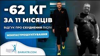  Як швидко схуднути без шкоди для здоров'я | Відгук про мінігастрошунтування