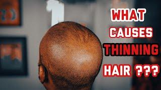 Best Haircut For BALDING MEN | Thinning Hair techniques - Episode 3