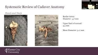 Case Study on a Popliteal Aneurysm - Kara Fadanelli