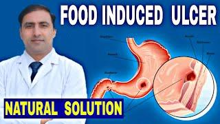 FOOD INDUCED ULCER || NATURAL SOLUTION || Dr Kumar education clinic