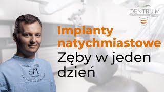 Implanty zębów, implanty natychmiastowe, zęby w jeden dzień