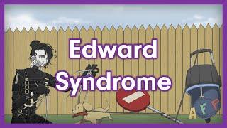 Edward Syndrome (Trisomy 18) | USMLE Step 1 Mnemonic