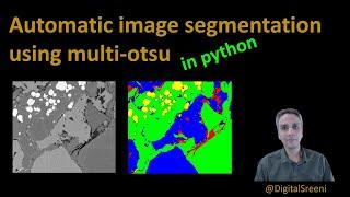 115 - Auto segmentation using multi-otsu