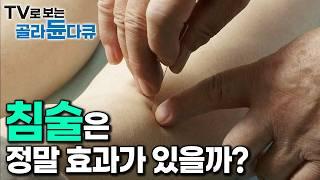 ‘불치병 치료 위해 미국 병원도 도입했다’ 동양 전통 의학 침술은 정말 효과가 있을까?｜다큐프라임｜#골라듄다큐