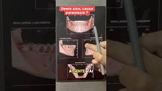 Não arranque Dente Siso sem Tomografia . #dentista #tomografia