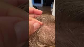 Lice picking l lice removal l small business #explore #hair #lice #hairvideo