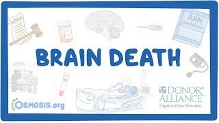 Donor Alliance - Brain Death