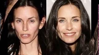 Celebrity Plastic Surgery Gossip and Pics Intro