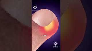 Stop Peeling Hangnails!  #shorts #youtubeshorts - creativelearning3d