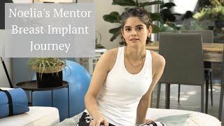 Mentor Breast Implants - Noelia's Implant Journey | The Harley Medical Group