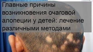 Главные причины возникновения очаговой алопеции у детей: лечение различными методами