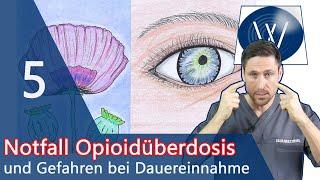 Opioidvergiftung durch Tilidin, Oxycodon & Co: Achten Sie auf diese Warnzeichen einer Überdosierung!