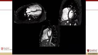 MonteHeart Multimodality Imaging Lecture with Shiraz Maskatia, MD