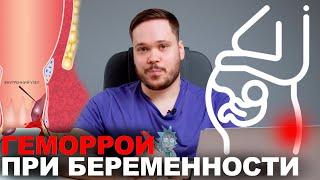 ГЕМОРРОЙ ПРИ БЕРЕМЕННОСТИ, ПРИЧИНЫ, ЛЕЧЕНИЕ, ПРОТИВОПОКАЗАНИЯ, ПРЕПАРАТЫ