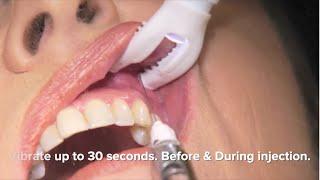 DentalVibe. How it works, a general instructional video