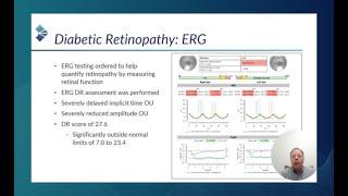 RETeval Optometric Case:  DR Score Helps Overcome Blind Faith in Weight Loss Drug (Jeff Calhoun, OD)