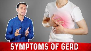 Symptoms of GERD (Gastroesophageal Reflux Disease) – Dr. Berg