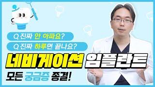 네비게이션 임플란트 궁금증, 이 영상으로 종결!