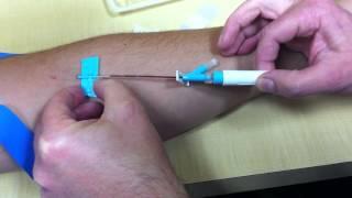 How to start a IV catheter for MRI scan