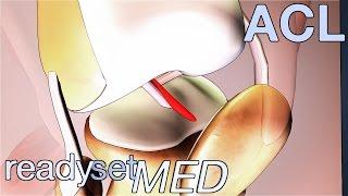 Which ACL Surgery is Right for Me? - ACL Series