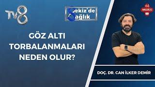 Göz Altı Torbalanmaları Neden Olur? | Doç. Dr. Can İlker Demir | 8'de Sağlık