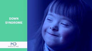 Down Syndrome - What you need to know about? - @mdmedicine.network