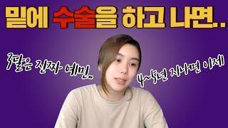 수술 5년차가 알려줄게 그걸 하면..