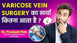 Cost of Varicose Veins Treatment in India with Actual Rates by Dr. Prashant Pote